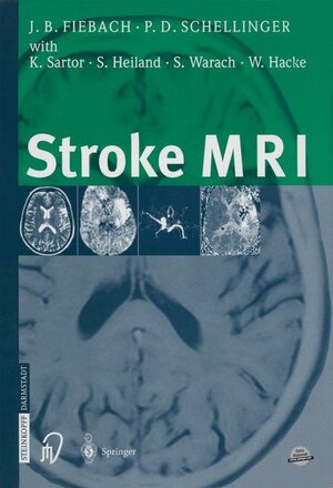 Buchcover Stroke MRI | Jochen Fiebach | EAN 9783798513723 | ISBN 3-7985-1372-4 | ISBN 978-3-7985-1372-3