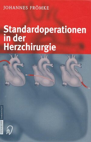 Buchcover Standardoperationen in der Herzchirurgie | Johannes Frömke | EAN 9783798514256 | ISBN 3-7985-1425-9 | ISBN 978-3-7985-1425-6