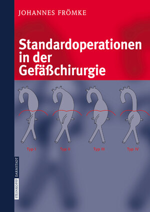 Buchcover Standardoperationen in der Gefäßchirurgie | Johannes Frömke | EAN 9783798514607 | ISBN 3-7985-1460-7 | ISBN 978-3-7985-1460-7