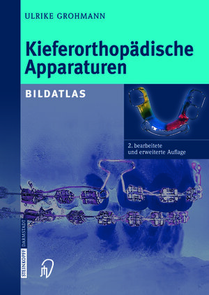 Buchcover Kieferorthopädische Apparaturen | Ulrike Grohmann | EAN 9783798515208 | ISBN 3-7985-1520-4 | ISBN 978-3-7985-1520-8