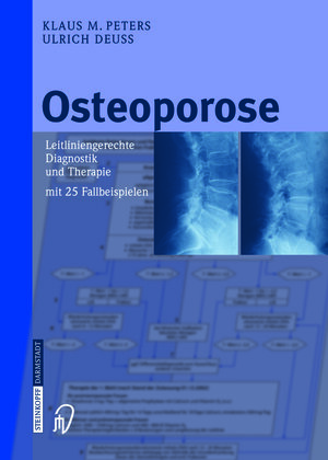 Buchcover Osteoporose | Klaus M. Peters | EAN 9783798515284 | ISBN 3-7985-1528-X | ISBN 978-3-7985-1528-4