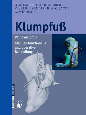 Buchcover Klumpfuß | G.U. Exner | EAN 9783798515383 | ISBN 3-7985-1538-7 | ISBN 978-3-7985-1538-3