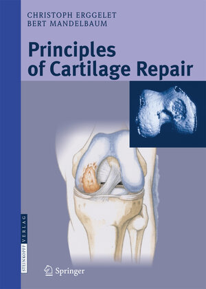 Buchcover Principles of Cartilage Repair | Christoph Erggelet | EAN 9783798515901 | ISBN 3-7985-1590-5 | ISBN 978-3-7985-1590-1