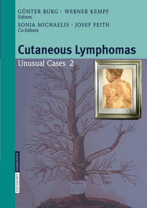 Buchcover Cutaneous Lymphomas  | EAN 9783798516106 | ISBN 3-7985-1610-3 | ISBN 978-3-7985-1610-6