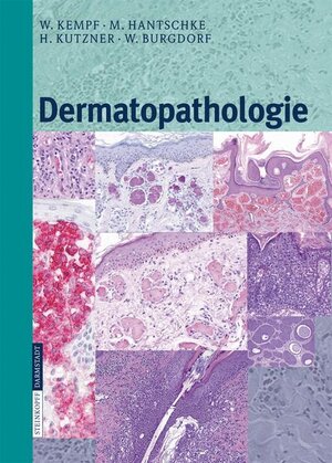 Buchcover Dermatopathologie | W. Kempf | EAN 9783798516472 | ISBN 3-7985-1647-2 | ISBN 978-3-7985-1647-2