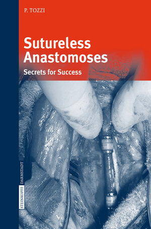 Buchcover Sutureless Anastomoses | Piergiorgio Tozzi | EAN 9783798517141 | ISBN 3-7985-1714-2 | ISBN 978-3-7985-1714-1