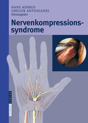 Buchcover Nervenkompressionssyndrome  | EAN 9783798518193 | ISBN 3-7985-1819-X | ISBN 978-3-7985-1819-3