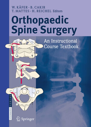 Buchcover Orthopaedic Spine Surgery  | EAN 9783798518285 | ISBN 3-7985-1828-9 | ISBN 978-3-7985-1828-5