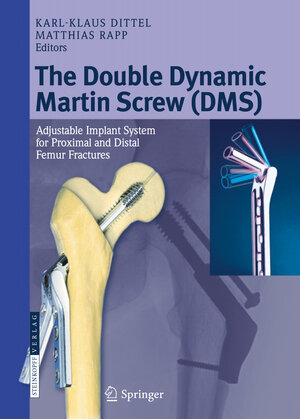Buchcover The Double Dynamic Martin Screw (DMS)  | EAN 9783798518414 | ISBN 3-7985-1841-6 | ISBN 978-3-7985-1841-4