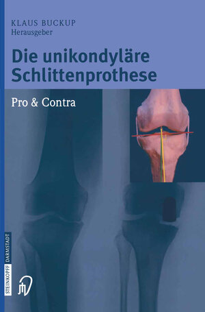 Buchcover Die unikondyläre Schlittenprothese Pro & Contra  | EAN 9783798519398 | ISBN 3-7985-1939-0 | ISBN 978-3-7985-1939-8