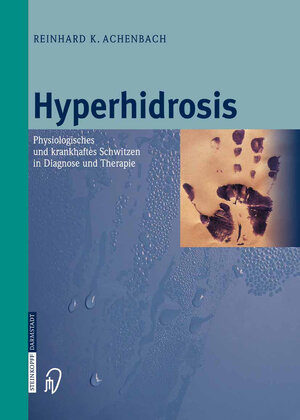 Buchcover Hyperhidrosis | R.K. Achenbach | EAN 9783798519459 | ISBN 3-7985-1945-5 | ISBN 978-3-7985-1945-9