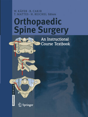 Buchcover Orthopaedic Spine Surgery  | EAN 9783798519701 | ISBN 3-7985-1970-6 | ISBN 978-3-7985-1970-1