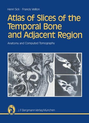 Buchcover Atlas of Slices of the Temporal Bone and Adjacent Region | Henri Sick | EAN 9783807003702 | ISBN 3-8070-0370-3 | ISBN 978-3-8070-0370-2