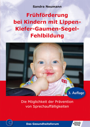 Buchcover Frühförderung bei Kindern mit Lippen-Kiefer-Gaumen-Segel-Fehlbildung | Sandra Neumann | EAN 9783824804030 | ISBN 3-8248-0403-4 | ISBN 978-3-8248-0403-0