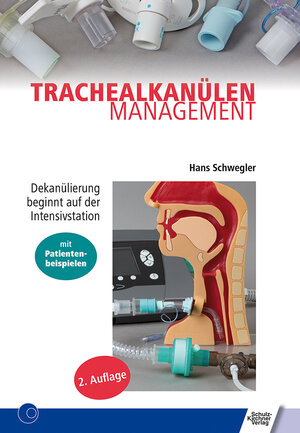 Buchcover Trachealkanülenmanagement | Hans Schwegler | EAN 9783824811625 | ISBN 3-8248-1162-6 | ISBN 978-3-8248-1162-5
