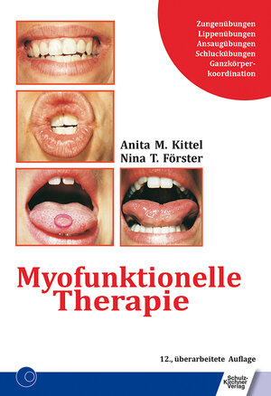 Buchcover Myofunktionelle Therapie | Anita Kittel | EAN 9783824812721 | ISBN 3-8248-1272-X | ISBN 978-3-8248-1272-1