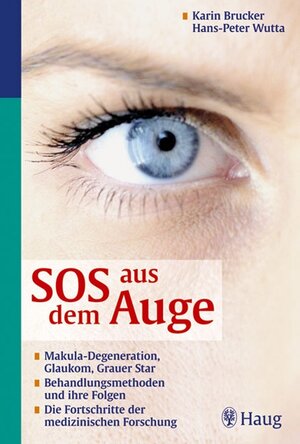 Buchcover SOS aus dem Auge | Karin Brucker | EAN 9783830421276 | ISBN 3-8304-2127-3 | ISBN 978-3-8304-2127-6