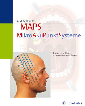 Buchcover MAPS - MikroAkuPunktSysteme | Jochen M Gleditsch | EAN 9783830452539 | ISBN 3-8304-5253-5 | ISBN 978-3-8304-5253-9