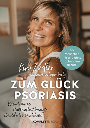 Buchcover Zum Glück Psoriasis | Kim Zeidler | EAN 9783831271276 | ISBN 3-8312-7127-5 | ISBN 978-3-8312-7127-6