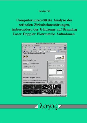 Computerunterstützte Analyse der retinalen Zirkulationsstörungen, insbesondere des Glaukoms auf Scanning Laser Doppler Flowmetrie Aufnahmen