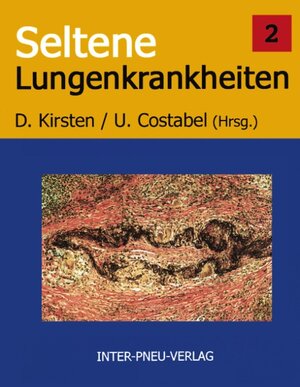 Buchcover Seltene Lungenkrankheiten. Band 2 | D Kirsten | EAN 9783833002595 | ISBN 3-8330-0259-X | ISBN 978-3-8330-0259-5