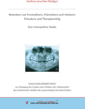 Buchcover Retention von Frontzähnen, Prämolaren und Molaren: Prävalenz und Therapieerfolg | Andreas Joachim Rüdiger | EAN 9783835965775 | ISBN 3-8359-6577-8 | ISBN 978-3-8359-6577-5