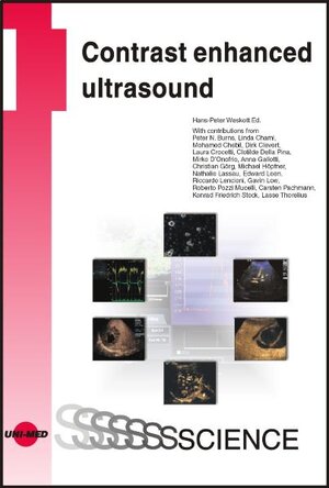 Buchcover Contrast enhanced ultrasound | Hans-Peter Weskott | EAN 9783837412215 | ISBN 3-8374-1221-0 | ISBN 978-3-8374-1221-5