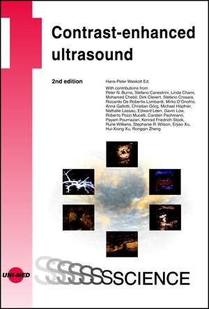 Buchcover Contrast-enhanced ultrasound | Hans-Peter Weskott | EAN 9783837414288 | ISBN 3-8374-1428-0 | ISBN 978-3-8374-1428-8