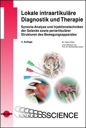 Buchcover Lokale intraartikuläre Diagnostik und Therapie | Hans Hatz | EAN 9783837415650 | ISBN 3-8374-1565-1 | ISBN 978-3-8374-1565-0