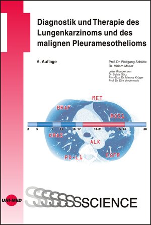 Buchcover Diagnostik und Therapie des Lungenkarzinoms und des malignen Pleuramesothelioms | Wolfgang Schütte | EAN 9783837416121 | ISBN 3-8374-1612-7 | ISBN 978-3-8374-1612-1