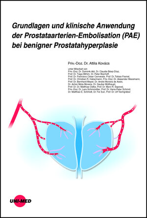 Buchcover Grundlagen und klinische Anwendung der Prostataarterien-Embolisation (PAE) bei benigner Prostatahyperplasie | Attila Kovács | EAN 9783837424355 | ISBN 3-8374-2435-9 | ISBN 978-3-8374-2435-5