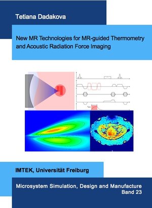 Buchcover New MR Technologies for MR-guided Thermometry and Acoustic Radiation Force Imaging | Tetiana Dadakova | EAN 9783843929882 | ISBN 3-8439-2988-2 | ISBN 978-3-8439-2988-2