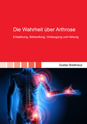 Buchcover Die Wahrheit über Arthrose | Gustav Breitkreuz | EAN 9783844059427 | ISBN 3-8440-5942-3 | ISBN 978-3-8440-5942-7