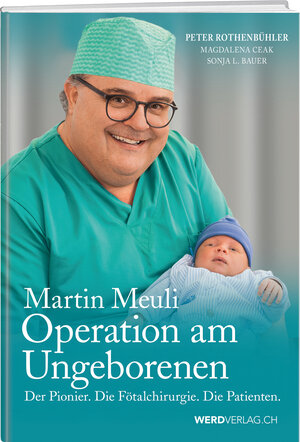 Buchcover Martin Meuli - Operation am Ungeborenen | Peter Rothenbühler | EAN 9783859328372 | ISBN 3-85932-837-9 | ISBN 978-3-85932-837-2