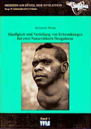 Buchcover Häufigkeit und Verteilung von Erkrankungen bei zwei Naturvölkern Neuguineas | Alexander Braun | EAN 9783861355717 | ISBN 3-86135-571-X | ISBN 978-3-86135-571-7