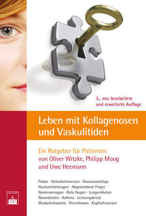 Buchcover Leben mit Kollagenosen und Vaskulitiden | Oliver Witzke | EAN 9783863711535 | ISBN 3-86371-153-X | ISBN 978-3-86371-153-5