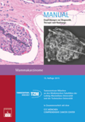 Buchcover Mammakarzinome  | EAN 9783863711788 | ISBN 3-86371-178-5 | ISBN 978-3-86371-178-8