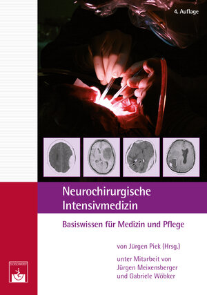 Buchcover Neurochirurgische Intensivmedizin | Jürgen Piek | EAN 9783863712303 | ISBN 3-86371-230-7 | ISBN 978-3-86371-230-3