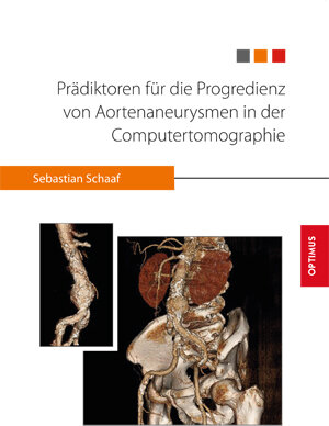 Buchcover Prädiktoren für die Progredienz von Aortenaneurysmen in der Computertomographie | Sebastian Schaaf | EAN 9783863761530 | ISBN 3-86376-153-7 | ISBN 978-3-86376-153-0