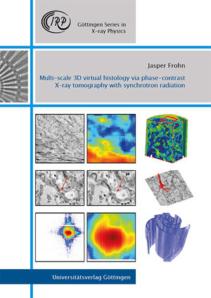 Buchcover Multi-scale 3D virtual histology via phase-contrast X-ray tomography with synchrotron radiation | Jasper Frohn | EAN 9783863956011 | ISBN 3-86395-601-X | ISBN 978-3-86395-601-1