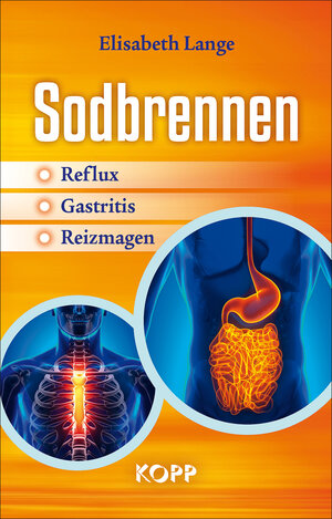Buchcover Sodbrennen | Elisabeth Lange | EAN 9783864453823 | ISBN 3-86445-382-8 | ISBN 978-3-86445-382-3