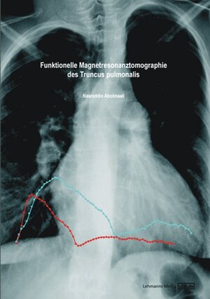 Buchcover Funktionelle Magnetresonanztomographie des Truncus pulmonalis | Nasreddin Abolmaali | EAN 9783865411440 | ISBN 3-86541-144-4 | ISBN 978-3-86541-144-0