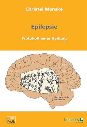 Buchcover Epilepsie: Protokoll einer Heilung | Christel Manske | EAN 9783865415103 | ISBN 3-86541-510-5 | ISBN 978-3-86541-510-3