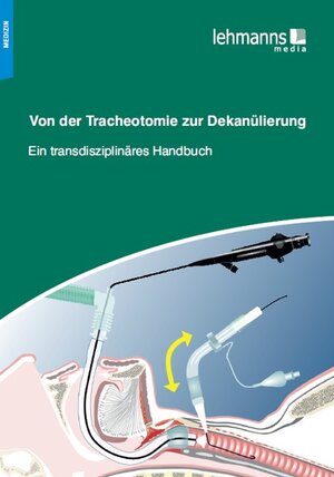 Buchcover Von der Tracheotomie zur Dekanülierung  | EAN 9783865415127 | ISBN 3-86541-512-1 | ISBN 978-3-86541-512-7