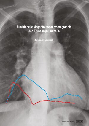 Buchcover Funktionelle Magnetresonanztomographie des Truncus pulmonalis | Nasreddin Abolmaali | EAN 9783865416445 | ISBN 3-86541-644-6 | ISBN 978-3-86541-644-5