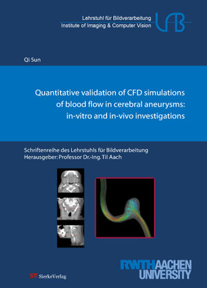 Buchcover Quantitative validation of CFD simulations of blood flow in cerebral aneurysms: | Sun Qi | EAN 9783868443837 | ISBN 3-86844-383-5 | ISBN 978-3-86844-383-7