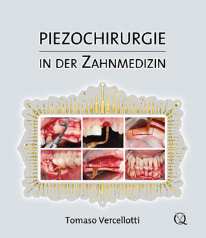 Buchcover Piezochirurgie in der Zahnmedizin | Tomaso Vercellotti | EAN 9783868670424 | ISBN 3-86867-042-4 | ISBN 978-3-86867-042-4