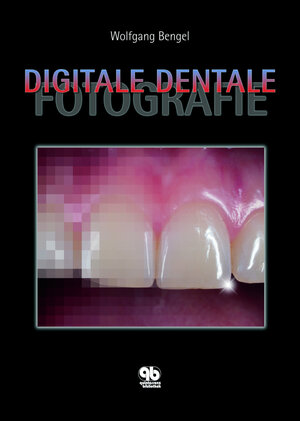 Buchcover Digitale Dentale Fotografie | Wolfgang Bengel | EAN 9783868670745 | ISBN 3-86867-074-2 | ISBN 978-3-86867-074-5
