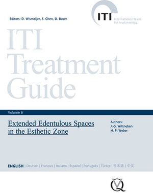 Buchcover Extended Edentulous Spaces in the Esthetic Zone | Julia-Gabriela Wittneben Matter | EAN 9783868671414 | ISBN 3-86867-141-2 | ISBN 978-3-86867-141-4