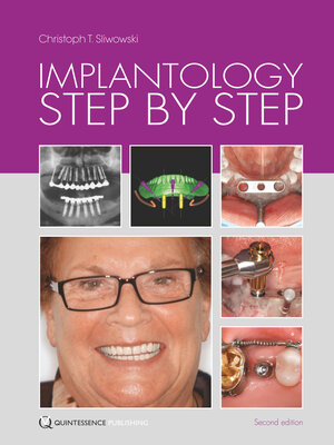 Buchcover Implantology Step by Step | Christoph T. Sliwowski | EAN 9783868672916 | ISBN 3-86867-291-5 | ISBN 978-3-86867-291-6